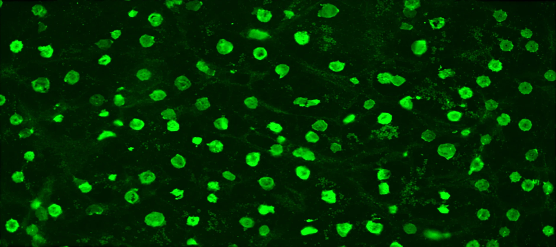 Fully Automated Immunofluorescence