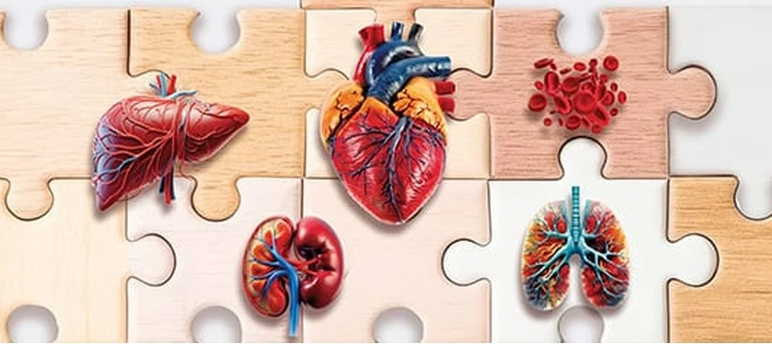 Transplant Immunology
