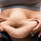 Being obese increases